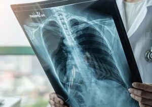 Advanced diagnostic center for radiology and imaging in Dehradun - Himalayan Diagnostics