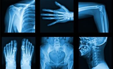 Digital X-ray service in Dehradun at Himalayan Diagnostic Centre near Rispana Bridge