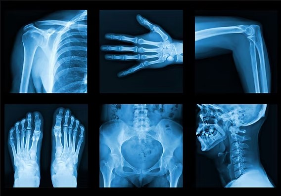 Digital X-ray service in Dehradun at Himalayan Diagnostic Centre near Rispana Bridge