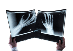 Modern digital X-ray facility at Himalayan Diagnostics Dehradun