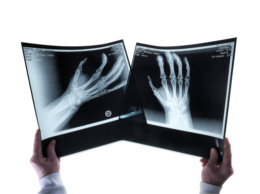 Modern digital X-ray facility at Himalayan Diagnostics Dehradun