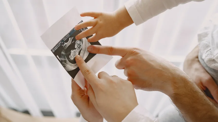 Prenatal ultrasound imaging at Himalayan Diagnostics in Dehradun