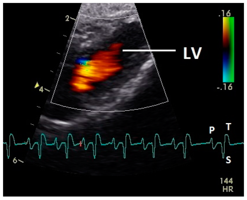Color Doppler Scan in Dehradun | Himalayan Diagnostics