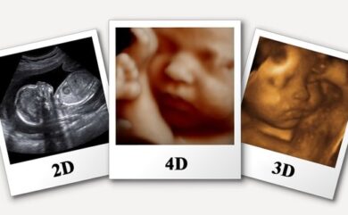 Book 3D 4D 5D ultrasound in Dehradun at Himalayan Diagnostics pregnancy scan center