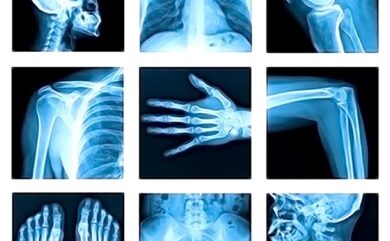 Himalayan Diagnostics radiology center – Modern diagnostic center providing high-quality X-ray imaging for joints