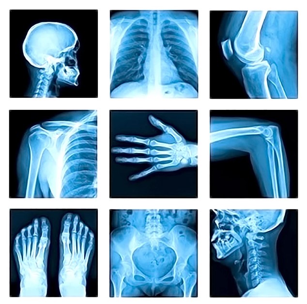 Himalayan Diagnostics radiology center – Modern diagnostic center providing high-quality X-ray imaging for joints