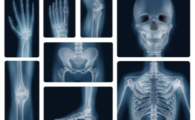 Digital X-ray services in Dehradun at Himalayan Diagnostics with advanced radiography technology