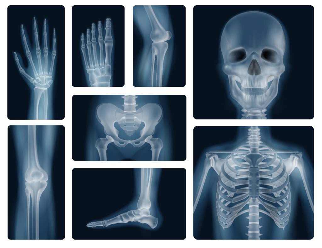 Digital X-ray services in Dehradun at Himalayan Diagnostics with advanced radiography technology